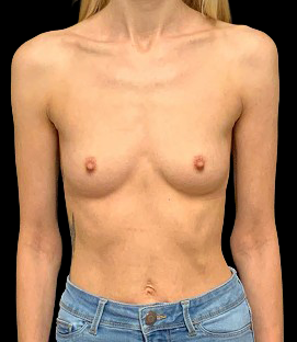 Before - DR97